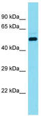 DDB1 And CUL4 Associated Factor 17 antibody, TA335885, Origene, Western Blot image 