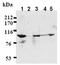 Catenin Beta 1 antibody, ADI-KAM-ST001-E, Enzo Life Sciences, Western Blot image 