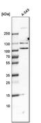 Sperm-associated antigen 5 antibody, HPA022479, Atlas Antibodies, Western Blot image 