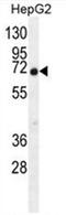 Chromosome 11 Open Reading Frame 95 antibody, AP50677PU-N, Origene, Western Blot image 