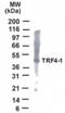 PAPD7 antibody, 49-227, ProSci, Western Blot image 