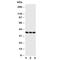 CD1a Molecule antibody, R30975, NSJ Bioreagents, Western Blot image 