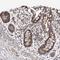 Transcription Factor B1, Mitochondrial antibody, HPA029428, Atlas Antibodies, Immunohistochemistry frozen image 