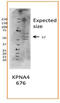 Karyopherin Subunit Alpha 4 antibody, TA335053, Origene, Western Blot image 