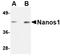 Nanos C2HC-Type Zinc Finger 1 antibody, orb75021, Biorbyt, Western Blot image 