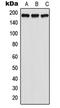 Probable G-protein coupled receptor 125 antibody, LS-C353652, Lifespan Biosciences, Western Blot image 