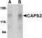 Calcium-dependent secretion activator 2 antibody, TA306562, Origene, Western Blot image 