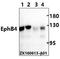 EPH Receptor B4 antibody, LS-B14141, Lifespan Biosciences, Western Blot image 