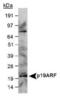 Cyclin-dependent kinase inhibitor 2A, isoforms 1/2/3 antibody, PA1-46220, Invitrogen Antibodies, Western Blot image 
