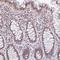 Nucleolar Protein 6 antibody, HPA055891, Atlas Antibodies, Immunohistochemistry frozen image 