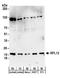 Ribosomal Protein L12 antibody, A303-940A, Bethyl Labs, Western Blot image 
