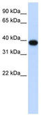Cyclin Dependent Kinase 1 antibody, TA344355, Origene, Western Blot image 