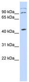 Zinc Finger Protein X-Linked antibody, TA334007, Origene, Western Blot image 