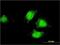 Enhancer Of MRNA Decapping 4 antibody, H00023644-M01, Novus Biologicals, Immunofluorescence image 