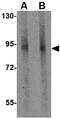 GLE1 RNA Export Mediator antibody, GTX31366, GeneTex, Western Blot image 