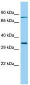 Radial Spoke Head 9 Homolog antibody, TA334369, Origene, Western Blot image 