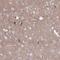 NUMBL antibody, HPA058251, Atlas Antibodies, Immunohistochemistry paraffin image 