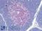 CD5 Molecule antibody, LS-B16101, Lifespan Biosciences, Immunohistochemistry paraffin image 