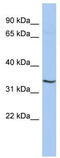 Ring Finger Protein 113B antibody, TA337736, Origene, Western Blot image 
