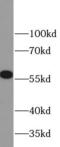 Matrix Metallopeptidase 23B antibody, FNab05241, FineTest, Western Blot image 