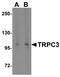 Transient Receptor Potential Cation Channel Subfamily C Member 3 antibody, NBP1-76722, Novus Biologicals, Western Blot image 