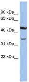 Potassium Two Pore Domain Channel Subfamily K Member 4 antibody, TA338723, Origene, Western Blot image 