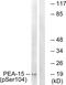 Proliferation And Apoptosis Adaptor Protein 15 antibody, PA5-37767, Invitrogen Antibodies, Western Blot image 