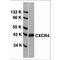 CD184 antibody, TA305935, Origene, Western Blot image 