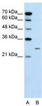BPI Fold Containing Family A Member 1 antibody, TA344133, Origene, Western Blot image 