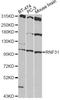 Ring Finger Protein 31 antibody, LS-C749150, Lifespan Biosciences, Western Blot image 