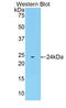 Stromelysin-3 antibody, LS-C295303, Lifespan Biosciences, Western Blot image 