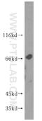 Kelch Like Family Member 21 antibody, 16952-1-AP, Proteintech Group, Western Blot image 