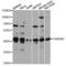 TAR DNA Binding Protein antibody, A13404, ABclonal Technology, Western Blot image 