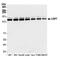 Ubiquitin Specific Peptidase 7 antibody, A300-033A, Bethyl Labs, Western Blot image 