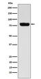 Solute Carrier Family 22 Member 3 antibody, M04914, Boster Biological Technology, Western Blot image 