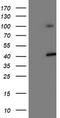 Proteasome 26S Subunit, Non-ATPase 2 antibody, TA503217, Origene, Western Blot image 