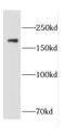 p190 antibody, FNab01298, FineTest, Western Blot image 