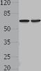PIF1 5'-To-3' DNA Helicase antibody, TA322173, Origene, Western Blot image 