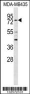 Regulatory Factor X3 antibody, 56-549, ProSci, Western Blot image 