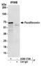 CDC73 antibody, A300-170A, Bethyl Labs, Immunoprecipitation image 
