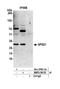 SPG21 Abhydrolase Domain Containing, Maspardin antibody, NBP2-59135, Novus Biologicals, Western Blot image 