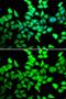Histone Deacetylase 7 antibody, GTX55655, GeneTex, Immunofluorescence image 