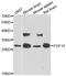Fibroblast Growth Factor 14 antibody, A6588, ABclonal Technology, Western Blot image 