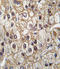 Cytochrome P450 Family 2 Subfamily C Member 9 antibody, LS-C97495, Lifespan Biosciences, Immunohistochemistry paraffin image 