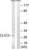 Chloride Intracellular Channel 3 antibody, abx014355, Abbexa, Western Blot image 