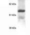 Methyl-CpG Binding Protein 2 antibody, GTX22828, GeneTex, Western Blot image 
