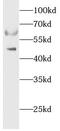 5'-Aminolevulinate Synthase 2 antibody, FNab00277, FineTest, Western Blot image 