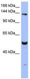 hMSH6 antibody, TA346016, Origene, Western Blot image 