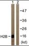 Histone H2B type 1 antibody, orb96073, Biorbyt, Western Blot image 