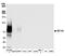 V-Set Domain Containing T Cell Activation Inhibitor 1 antibody, A700-043, Bethyl Labs, Western Blot image 